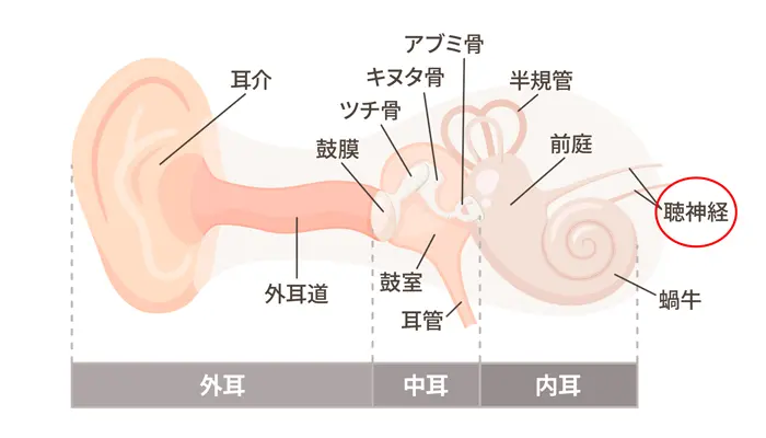 聴神経腫瘍 | 浦和駅ユーカリ耳鼻咽喉科